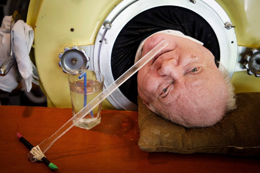 Texas man who lived in iron lung after getting polio dies at 78