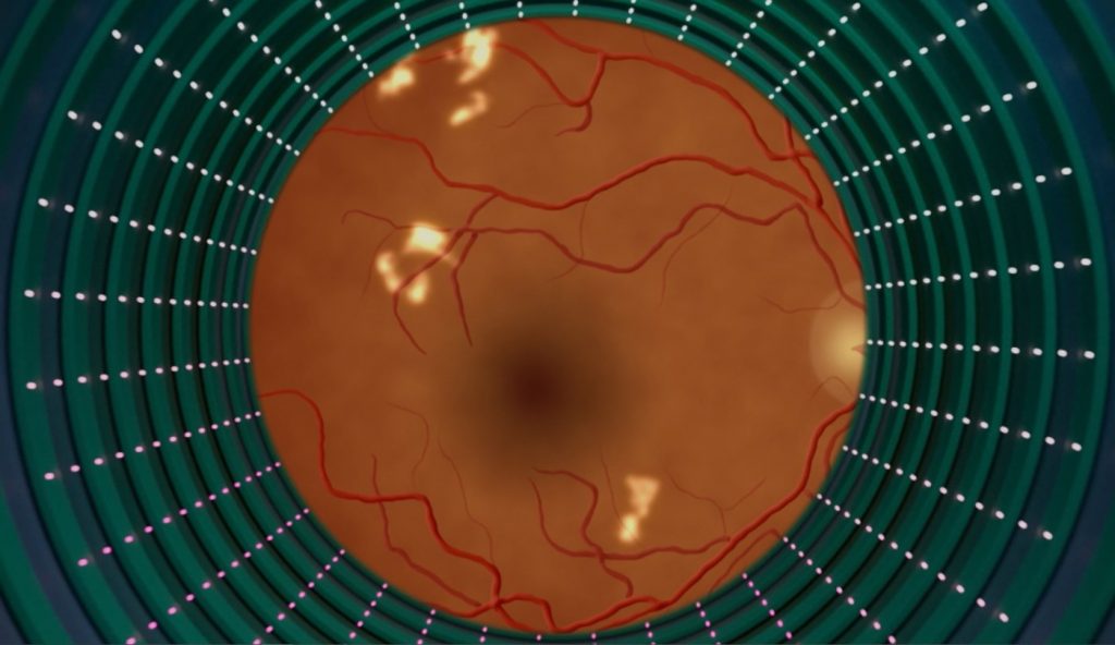 As AI eye exams prove their worth, lessons for future tech emerge