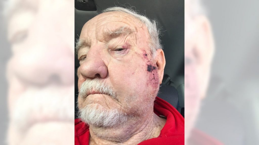 Felony charges filed in beating of 81-year-old man at California Elks Lodge