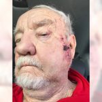 Felony charges filed in beating of 81-year-old man at California Elks Lodge